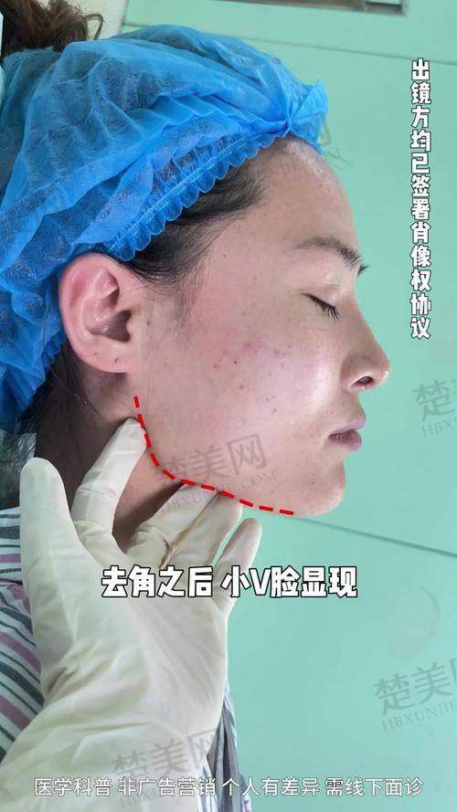 二、上海首尔丽格医疗美容医院：磨骨手术的优质平台