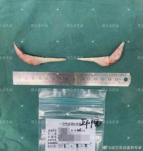 一、刘正茂医生简介