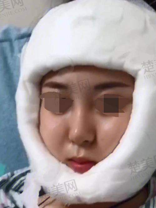 一、广州柳超医生背景与资历
