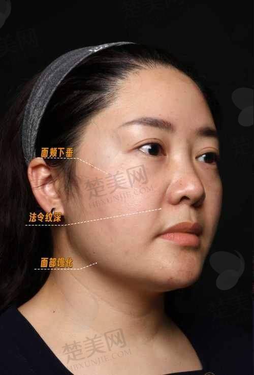 三、懿和唯美医疗美容医院——怕痛者的福音