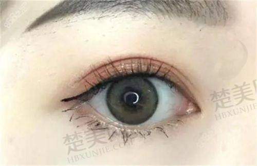 七、嘉兴禾美医疗美容医院