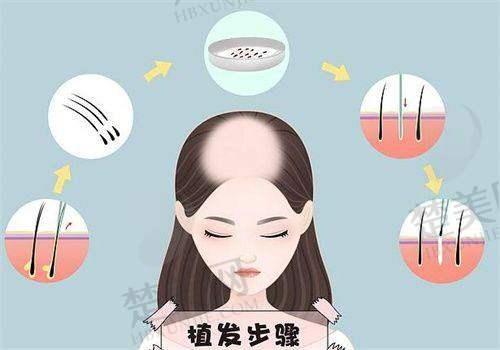三、合肥曙光植发医院周边环境大揭秘