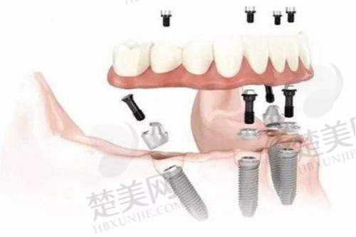 八、桂平益美口腔门诊部预约方式