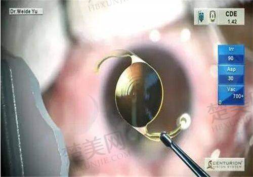 二、北京熙仁眼科医院诊疗项目