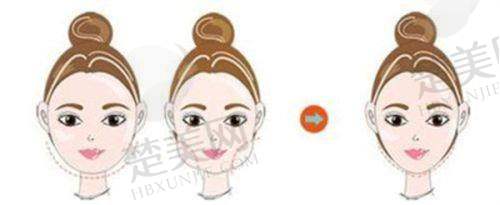 八、绵阳韩美医疗美容门诊部预约方式