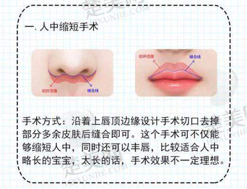 九、徐圣凯医生——深圳弘美医疗美容整形门诊部