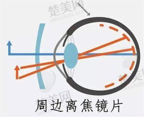 一、普瑞眼科医院介绍