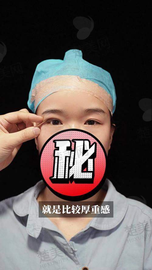 一、嘉兴市第一医院烧伤整形科