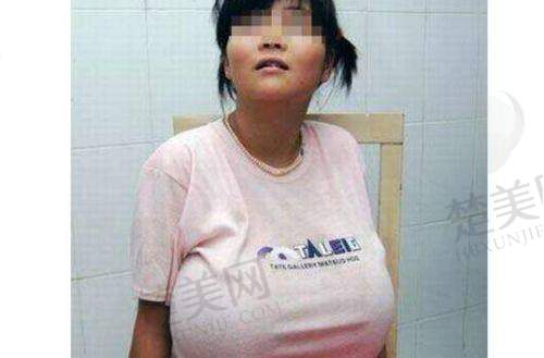 三、陆 军特色医学中 心（大坪医院）整形美容科：九十年代老牌科室的实力沉淀