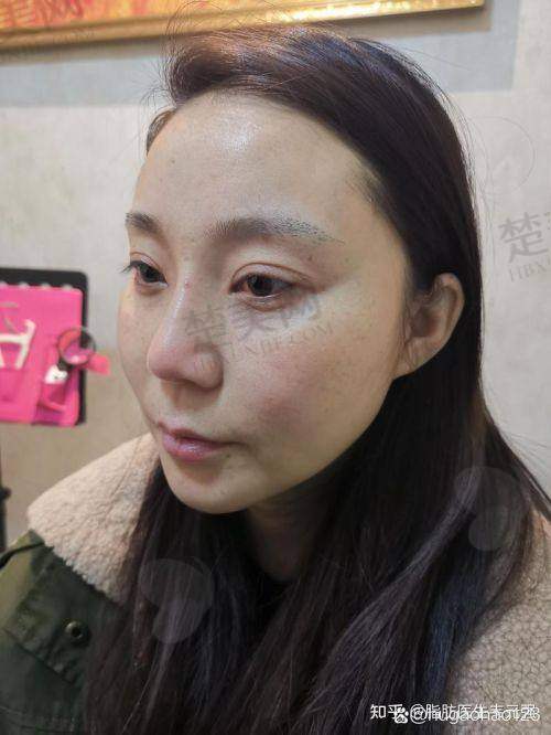 五、顾客评价与实例分享