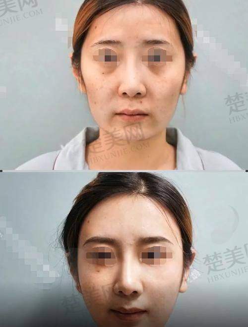 一、郑州脂肪填充有医生生排名揭晓