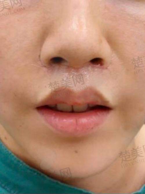 六、周东良医生——深圳南西子医疗美容整形门诊部