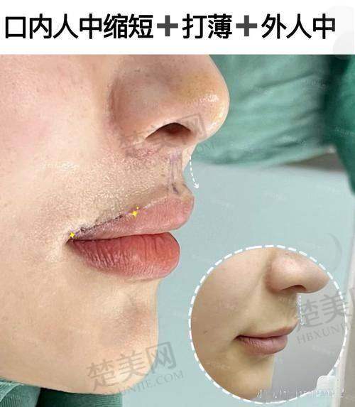 八、江环环医生——深圳素仁医疗整形美容门诊部