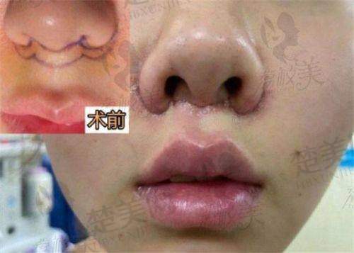 七、翟万性医生——[医疗美容整形门诊部]