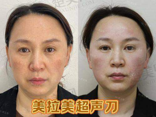 九、沈阳和平百嘉丽医疗美容院