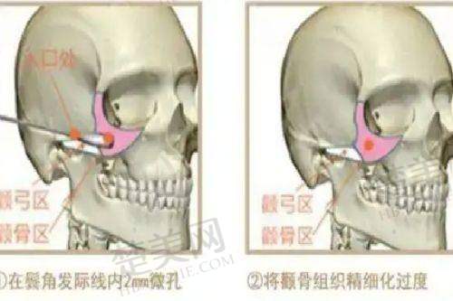 三、成都市二医院整形美容科医生坐诊时间:根据需求选对“主刀”