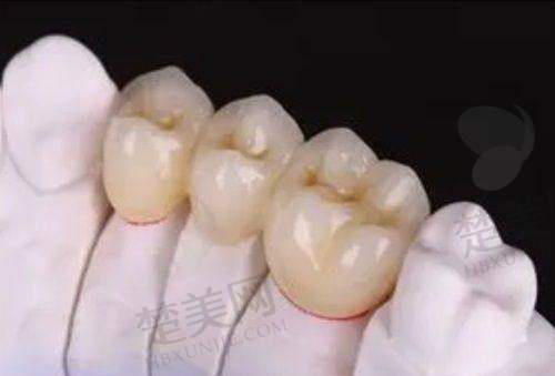 三、诸暨铭阳口腔诊所诊疗项目有哪些?
