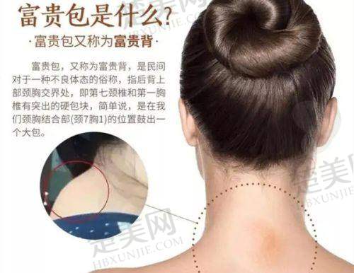 四、西宁夏都医疗美容门诊部特色项目