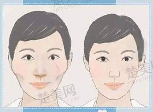 (四)吉林大学第二医院整形美容外科