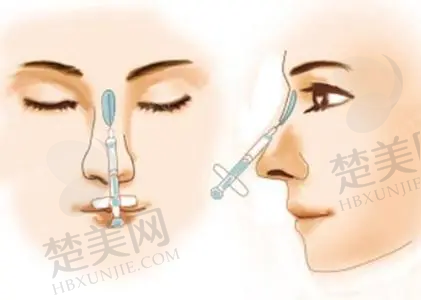 五、总结