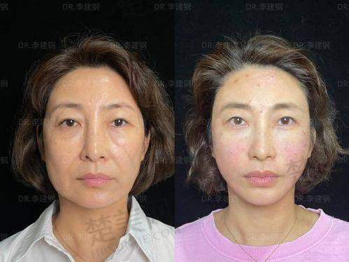 三、北京吸脂整形骨干医生推荐