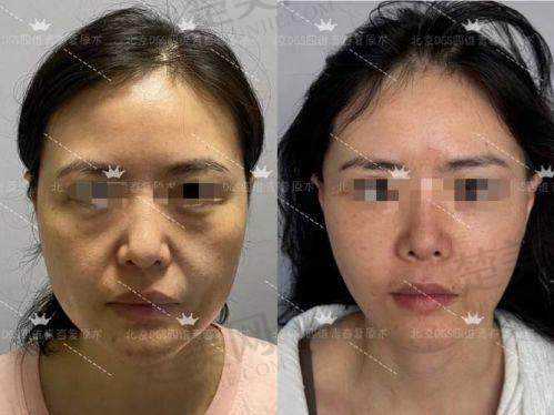 十、北京注射整形骨干医生推荐