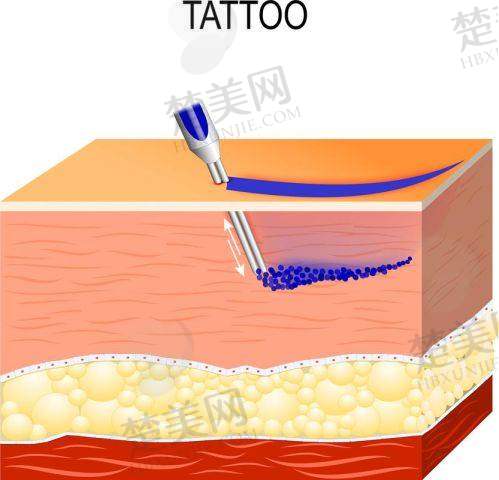五、昆明祛疤痕费用参考总结