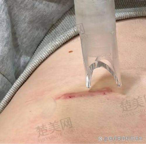 三、云南美莱整形