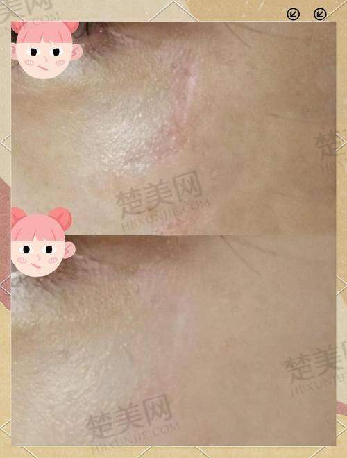四、云南昆明韩辰医疗美容医院