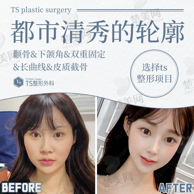 四、北京磨骨整形骨干医生推荐