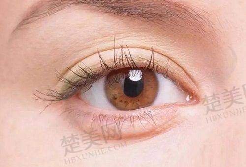 1. 个性化设计