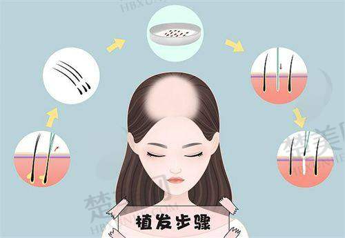 七、临沂爱美医疗美容植发科