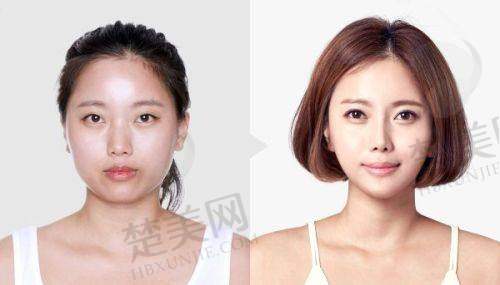 七、浙江台州温岭芘丽芙整形美容医院