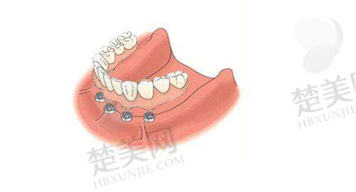 五、滨州中悦口腔（种植总院）