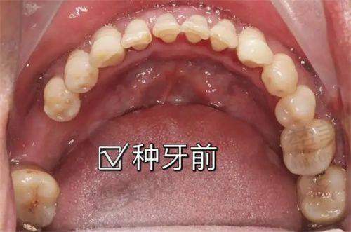 一、丹阳金铂利口腔：连锁实力，疑难修复骨干医生