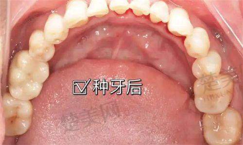 三、丹阳东方口腔：优质环境，手术成功保护