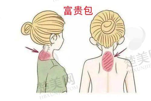 五、西安俪时代整形医院的价格和消费透明
