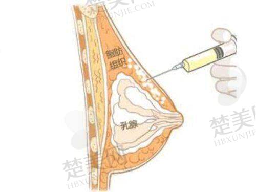 二、西安俪时代整形医院的技术优势