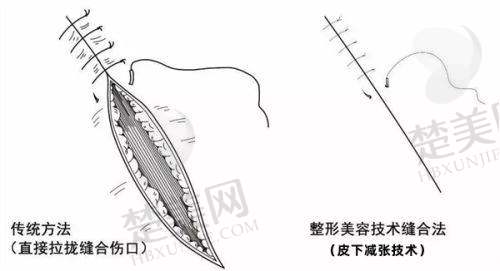 在追求美的道路上，选择一家正规靠谱的美容医院至关重要。2025广州正规美容医院排名前十揭晓，各有特色项目助你实现美丽蜕变。接下来，就为大家详细介绍这十家医院。