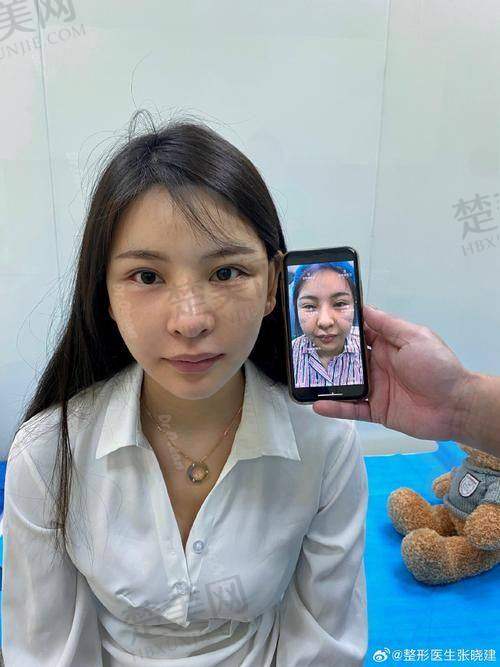 四、佛山美莱整形——连锁优势，效率高整形