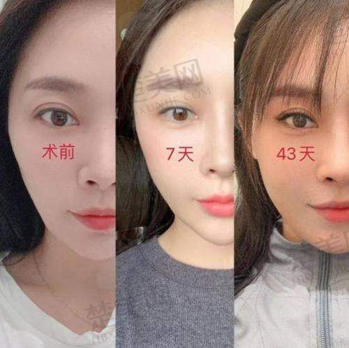 选择合肥美泽，开启美丽之旅