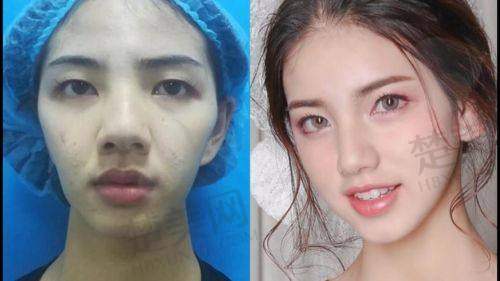 三、合肥美泽医疗美容医院张院长：专精与敬业的化身