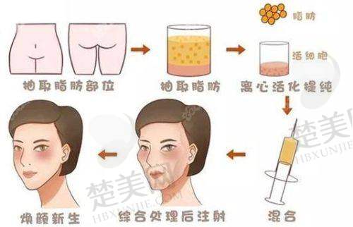 一、合肥美泽医疗美容医院：正规靠谱的变得更美之选