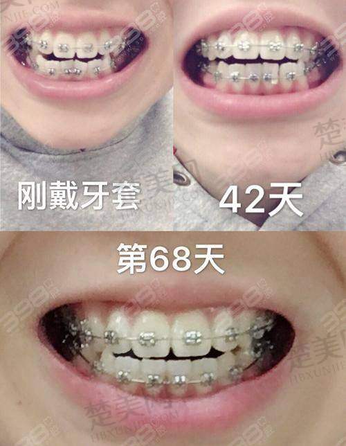 八、忻州齿科医院