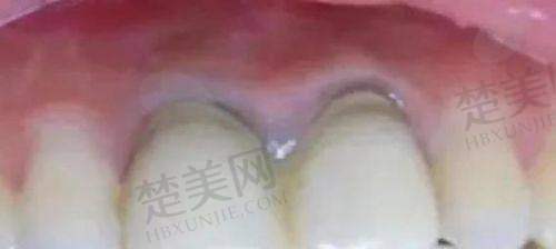 三、河南周口牙贝康口腔门诊部镶牙情况
