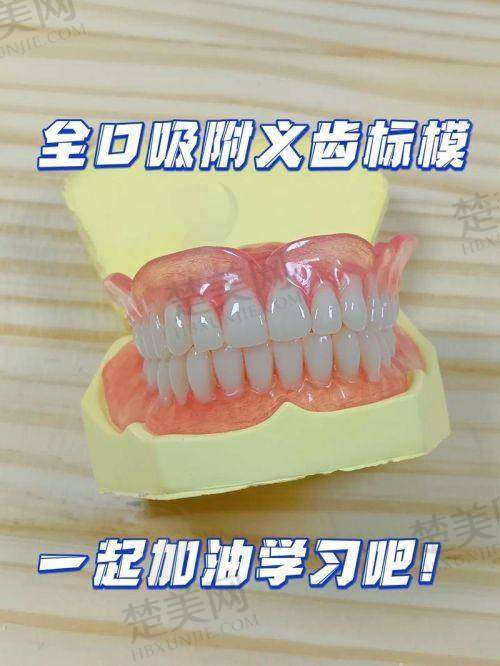 三、深圳镶牙便宜又好的牙科推荐