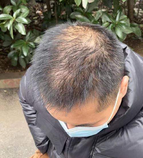 一、厦门碧莲盛植发之医院位置与环境