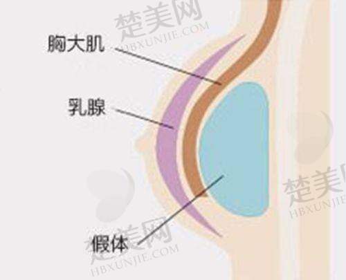 六、上海伯思立医院——隆鼻隆胸吸脂的综合强者