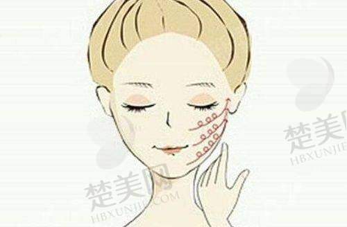九、昆明杰西艾整形外科医院真实的患者评价