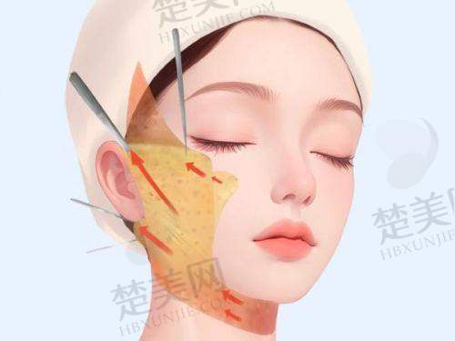 总结：选择适合的整形医院